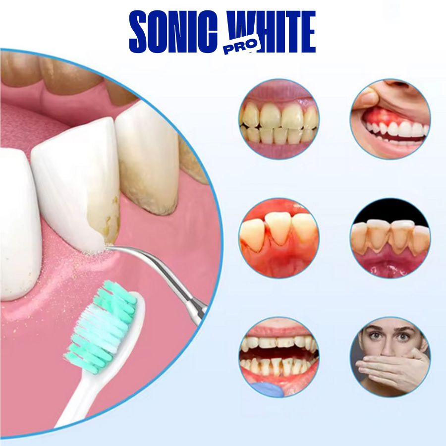SONICWHITE PRO - El Cepillo Que Revoluciona Tu Sonrisa